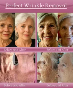 Jorondy® Anti-Wrinkle Skin Cream for Remove Wrinkles