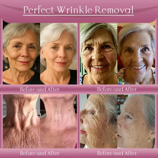 Jorondy® Anti-Wrinkle Skin Cream for Remove Wrinkles