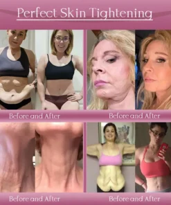 Jorondy® Anti-Wrinkle Skin Cream for Remove Wrinkles