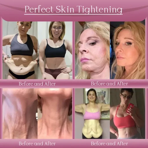 Jorondy® Anti-Wrinkle Skin Cream for Remove Wrinkles