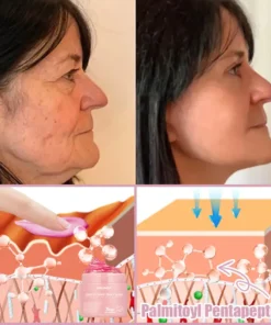 Jorondy® Anti-Wrinkle Skin Cream for Remove Wrinkles