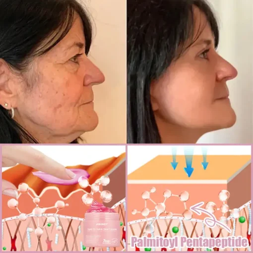 Jorondy® Anti-Wrinkle Skin Cream for Remove Wrinkles