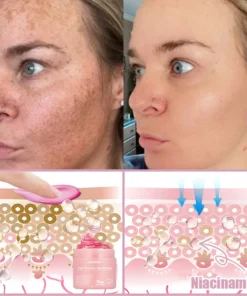 Jorondy® Anti-Wrinkle Skin Cream for Remove Wrinkles