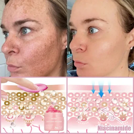 Jorondy® Anti-Wrinkle Skin Cream for Remove Wrinkles