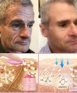 Jorondy® Anti-Wrinkle Skin Cream for Remove Wrinkles