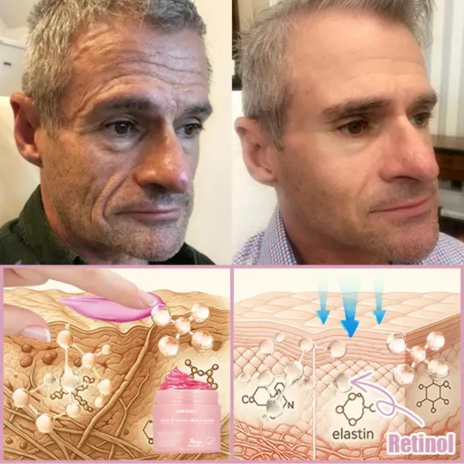 Jorondy® Anti-Wrinkle Skin Cream for Remove Wrinkles