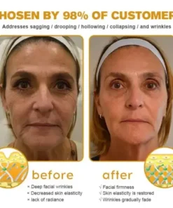 Jorondy® Instant skin tightening Cream