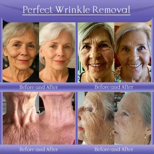 Jorondy® Skin Firming & Anti-Wrinkle Cream