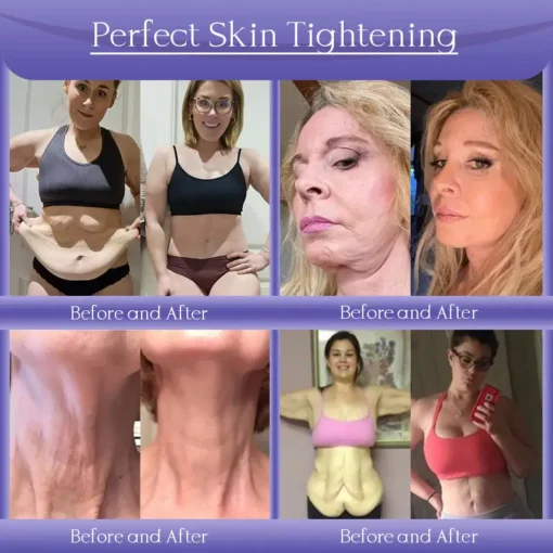 Jorondy® Skin Firming & Anti-Wrinkle Cream