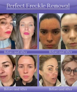 Jorondy® Skin Firming & Anti-Wrinkle Cream
