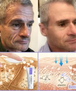 Jorondy® Skin Firming & Anti-Wrinkle Cream