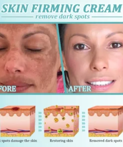 Jorondy® Skin Firming Cream