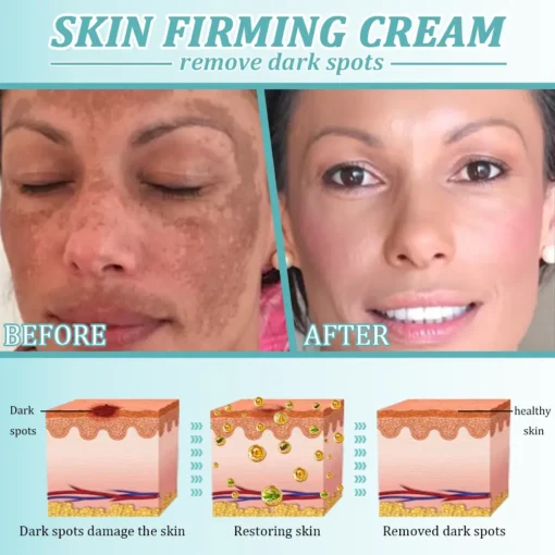 Jorondy® Skin Firming Cream