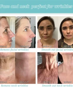 Jorondy® Skin Firming Cream