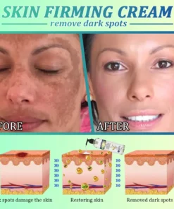 Jorondy® Skin Firming O
