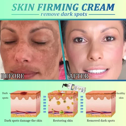 Jorondy® Skin Firming O