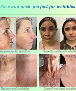 Jorondy® Skin Firming O