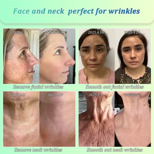 Jorondy® Skin Firming O