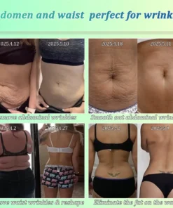 Jorondy® Skin Firming O