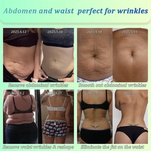 Jorondy® Skin Firming O