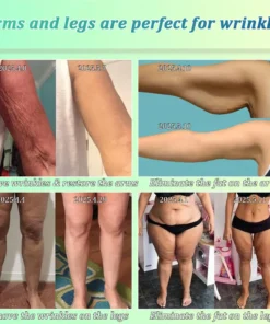 Jorondy® Skin Firming O