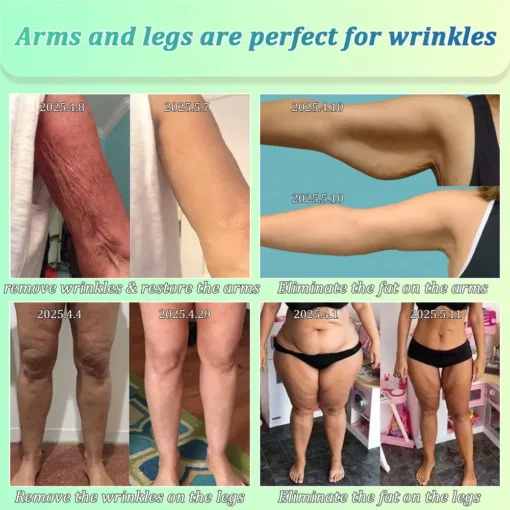 Jorondy® Skin Firming O