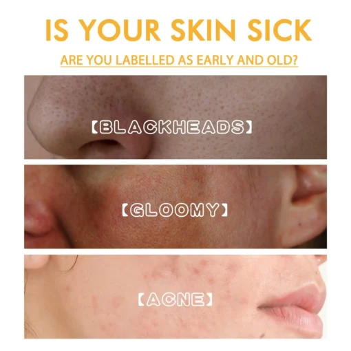 𝗝𝗼𝗿𝗼𝗻𝗱𝘆® Honey Tear-Off Mask Anti-Aging