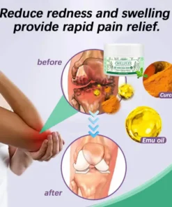 JORONDY® CHILLFLEX Herbal Pain Relief Cream