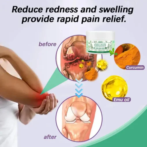 JORONDY® CHILLFLEX Herbal Pain Relief Cream