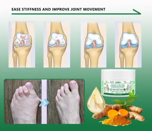 JORONDY® CHILLFLEX Herbal Pain Relief Cream