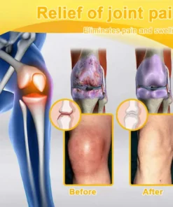 Jorondy® Bee Venom Pain-Relief Bone Healing Spray