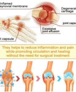 Jorondy® Bee Venom Pain-Relief Bone Healing Spray