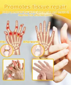 Jorondy® Bee Venom Pain-Relief Bone Healing Spray