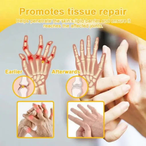 Jorondy® Bee Venom Pain-Relief Bone Healing Spray