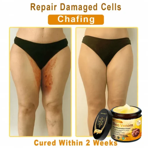 Jorondy® Skin Treatment Cream