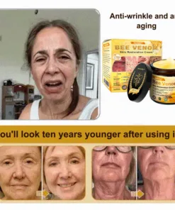 Jorondy® Skin Treatment Cream