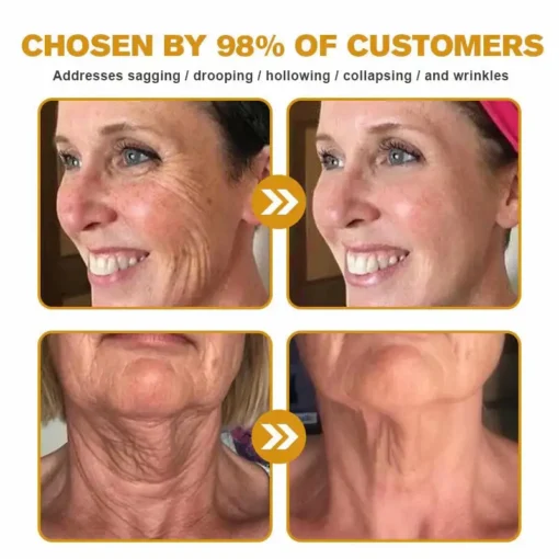 Jorondy® Skin Treatment Cream