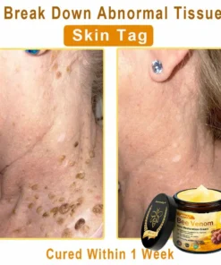 Jorondy® Skin Treatment Cream