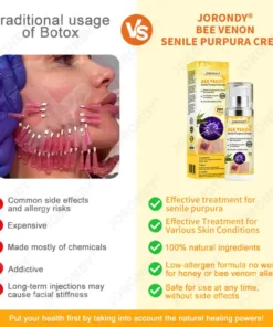JORONDY® Bee Venom Senile Purpura Cream