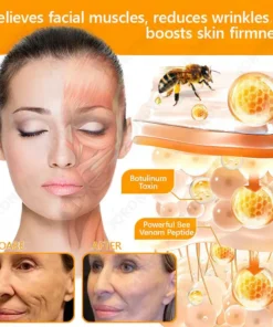 JORONDY® Bee Venom Senile Purpura Cream
