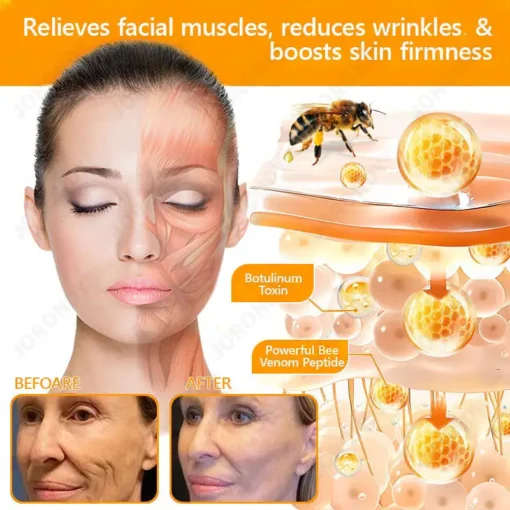 JORONDY® Bee Venom Senile Purpura Cream