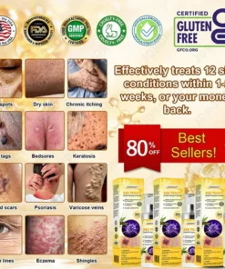 JORONDY® Bee Venom Senile Purpura Cream